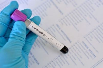 Coronavírus-divulgação-1.jpg
