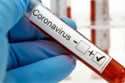 Coronavírus-foto-Divulgação.jpg