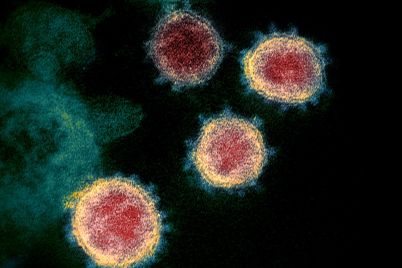 Coronavírus-foto-reprodução-internet.jpg