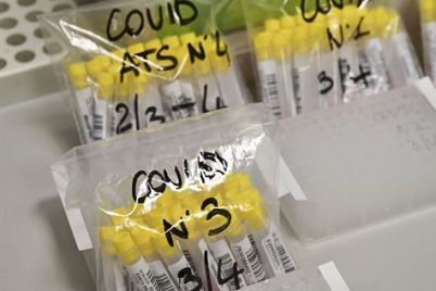 Coronavírus-testes-AFP-1.jpg