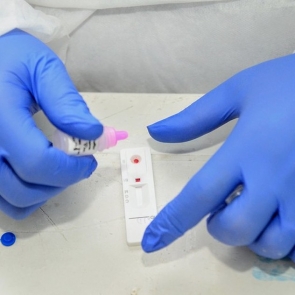 Nesta sexta-feira(14), Caruaru notifica 41 novas infecções por COVID-19 e 12 de H3N2