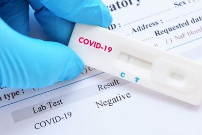 teste-rapido-coronavirus-covid19.jpg