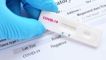 teste-rapido-coronavirus-covid19