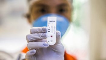 NITEROI, BRAZIL - APRIL 30: A health care worker holds a test for patients suspected of being infected with for the coronavirus (COVID-19) at the Center Health Vicoso Jardim, on April 30, 2020 in Niteroi, Brazil. AccordBrazil currently has over 80,000 confirmed cases of coronavirus (COVID-19) and over 5,500 registered deaths. (Photo by Luis Alvarenga/Getty Images)